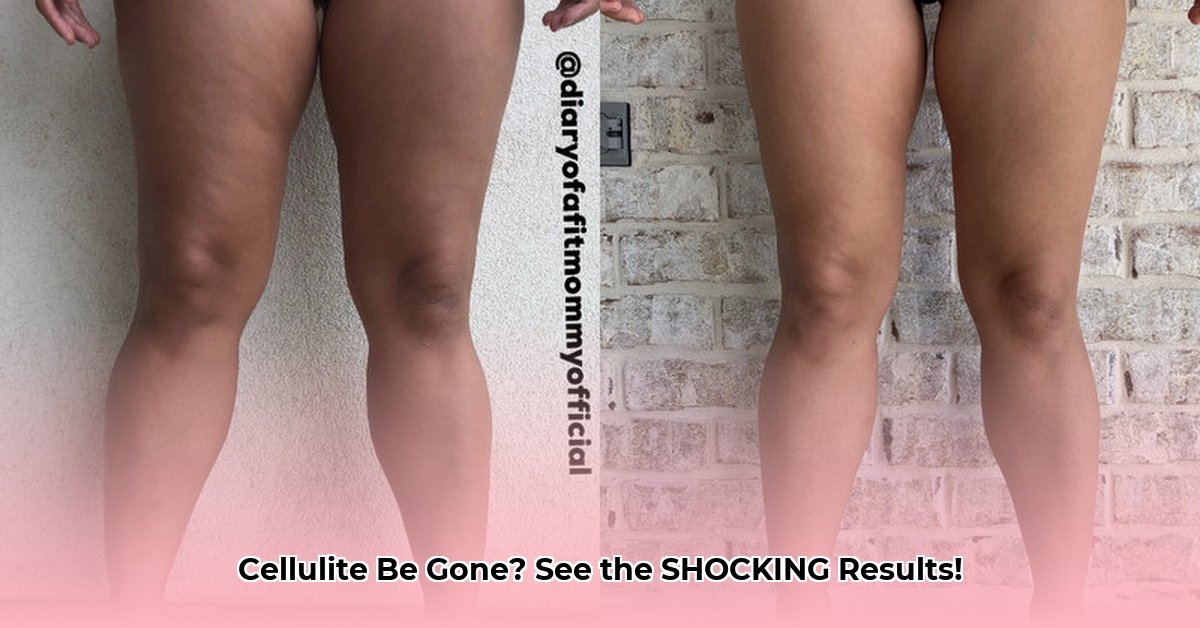 weight-loss-cellulite-before-after